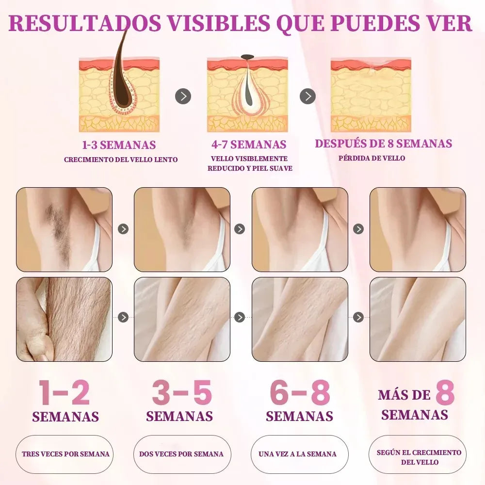Depiladora Láser IPL Profesional Sin Dolor – Resultados Permanentes en Casa